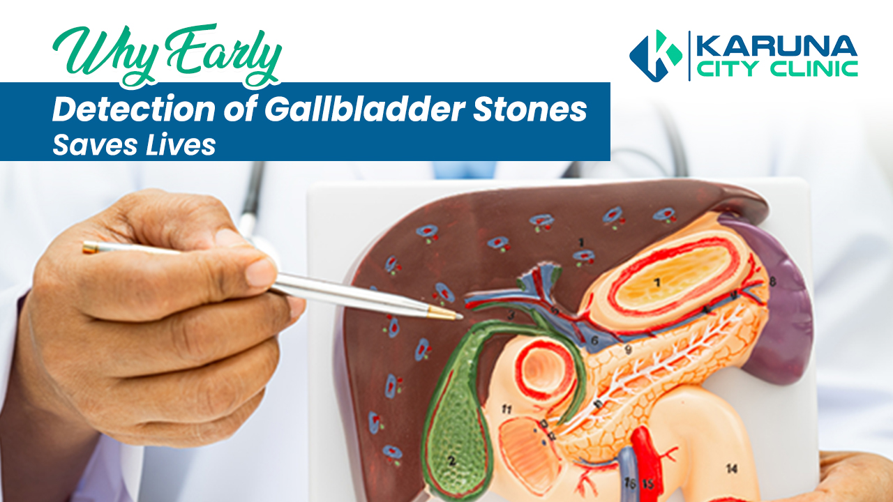 Gallbladder stone