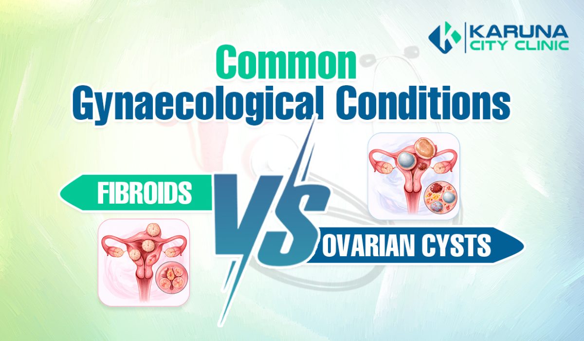 Fibroids Cysts